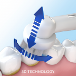 pro clean elektrische tandenborstel