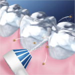 Ervaringen Oral-B Oxyjet monddouche met luchtbeltechnologie